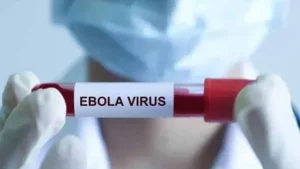 Ebola virus can spread across the world through airports