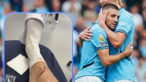 Erling Haaland took his injury with humor