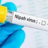 Вирус Нипах: В Узбекистане опасности нет, будьте осторожны! Вирус Нипах: В Узбекистане опасности нет, будьте осторожны!